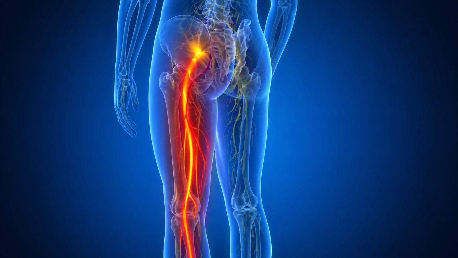 Representation of an inflamed sciatic nerve